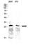 Mitochondrial Ribosome Recycling Factor antibody, A09708-2, Boster Biological Technology, Western Blot image 