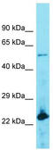 Acyl-CoA Thioesterase 4 antibody, TA344353, Origene, Western Blot image 