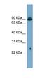 Solute Carrier Family 6 Member 5 antibody, orb325099, Biorbyt, Western Blot image 