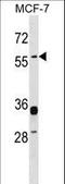 Syncytin-1 antibody, LS-C167820, Lifespan Biosciences, Western Blot image 