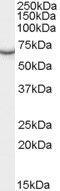 Phosphoenolpyruvate Carboxykinase 1 antibody, GTX89064, GeneTex, Western Blot image 