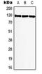 BMP2 Inducible Kinase antibody, LS-C353849, Lifespan Biosciences, Western Blot image 