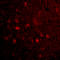 Mitochondrial Antiviral Signaling Protein antibody, LS-B617, Lifespan Biosciences, Immunofluorescence image 