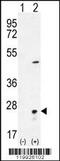 Visinin Like 1 antibody, MBS9209388, MyBioSource, Western Blot image 