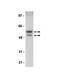 Glycogen Synthase Kinase 3 Alpha antibody, NBP2-29873, Novus Biologicals, Western Blot image 