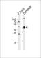 Adenosine Deaminase antibody, PA5-72657, Invitrogen Antibodies, Western Blot image 