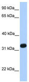 Acrosomal Vesicle Protein 1 antibody, TA335863, Origene, Western Blot image 