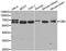Cystathionine-Beta-Synthase antibody, A1427, ABclonal Technology, Western Blot image 