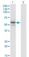 Alpha-L-Fucosidase 1 antibody, LS-C197248, Lifespan Biosciences, Western Blot image 