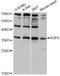 Aquaporin 4 antibody, STJ22661, St John