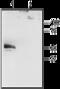 Potassium Two Pore Domain Channel Subfamily K Member 4 antibody, GTX16684, GeneTex, Western Blot image 