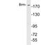 SWI/SNF Related, Matrix Associated, Actin Dependent Regulator Of Chromatin, Subfamily A, Member 2 antibody, LS-C199778, Lifespan Biosciences, Western Blot image 