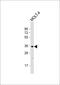 Glycosyltransferase 6 Domain Containing 1 antibody, 61-334, ProSci, Western Blot image 