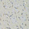 Ribonucleic Acid Export 1 antibody, LS-C334899, Lifespan Biosciences, Immunohistochemistry paraffin image 