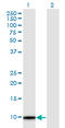 Thymosin Beta 4 Y-Linked antibody, LS-C139459, Lifespan Biosciences, Western Blot image 