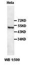 Rho GDP Dissociation Inhibitor Alpha antibody, orb77180, Biorbyt, Western Blot image 