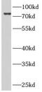 Armadillo Repeat Containing 8 antibody, FNab00587, FineTest, Western Blot image 