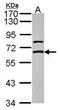 Gamma-Aminobutyric Acid Type A Receptor Epsilon Subunit antibody, PA5-30255, Invitrogen Antibodies, Western Blot image 