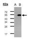 Transcriptional Adaptor 3 antibody, PA5-27591, Invitrogen Antibodies, Western Blot image 