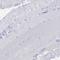 ALMS1 Centrosome And Basal Body Associated Protein antibody, HPA043200, Atlas Antibodies, Immunohistochemistry frozen image 