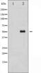 Tubulin Gamma 1 antibody, abx012292, Abbexa, Western Blot image 