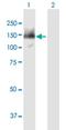 SWI/SNF-related matrix-associated actin-dependent regulator of chromatin subfamily A containing DEAD/H box 1 antibody, H00056916-B01P, Novus Biologicals, Western Blot image 