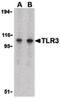 Toll Like Receptor 3 antibody, PA5-20183, Invitrogen Antibodies, Western Blot image 
