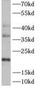 Anti-Silencing Function 1A Histone Chaperone antibody, FNab00631, FineTest, Western Blot image 