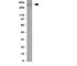 ATP Binding Cassette Subfamily A Member 4 antibody, R31177, NSJ Bioreagents, Western Blot image 