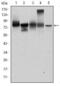 Junction Plakoglobin antibody, MA5-15905, Invitrogen Antibodies, Western Blot image 