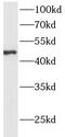 Acid Phosphatase 6, Lysophosphatidic antibody, FNab00101, FineTest, Western Blot image 