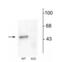 Gamma-Aminobutyric Acid Type A Receptor Alpha1 Subunit antibody, NB300-191, Novus Biologicals, Western Blot image 