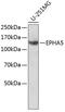 EPH Receptor A5 antibody, 23-361, ProSci, Western Blot image 