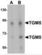 Transglutaminase-5 antibody, NBP2-81857, Novus Biologicals, Western Blot image 