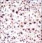 Small Nuclear Ribonucleoprotein Polypeptide A antibody, LS-C161351, Lifespan Biosciences, Immunohistochemistry frozen image 