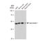 Arrestin Beta 1 antibody, GTX02840, GeneTex, Western Blot image 