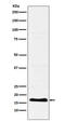 Trefoil Factor 2 antibody, M07013, Boster Biological Technology, Western Blot image 