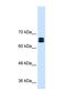 Solute Carrier Family 9 Member A9 antibody, NBP1-59901, Novus Biologicals, Western Blot image 