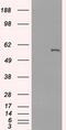 Cytochrome P450 Family 2 Subfamily E Member 1 antibody, MA5-25005, Invitrogen Antibodies, Western Blot image 