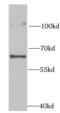 Ribophorin II antibody, FNab07451, FineTest, Western Blot image 