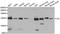 Vinculin antibody, A14193, ABclonal Technology, Western Blot image 