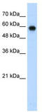 SWI/SNF Related, Matrix Associated, Actin Dependent Regulator Of Chromatin, Subfamily D, Member 2 antibody, TA335791, Origene, Western Blot image 