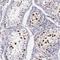 Minichromosome Maintenance Complex Component 5 antibody, NBP1-85722, Novus Biologicals, Immunohistochemistry frozen image 