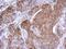 Phosphatase, Orphan 2 antibody, GTX119798, GeneTex, Immunohistochemistry paraffin image 
