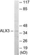 ALX Homeobox 3 antibody, EKC1657, Boster Biological Technology, Western Blot image 