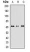 Receptor Interacting Serine/Threonine Kinase 2 antibody, orb382010, Biorbyt, Western Blot image 
