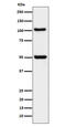 Oxysterol Binding Protein Like 1A antibody, M09676, Boster Biological Technology, Western Blot image 