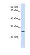 Unc-50 Inner Nuclear Membrane RNA Binding Protein antibody, NBP1-59665, Novus Biologicals, Western Blot image 