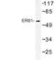 ETS Variant 1 antibody, LS-C177016, Lifespan Biosciences, Western Blot image 