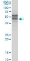 Transcription Factor 7 antibody, H00006932-M06, Novus Biologicals, Western Blot image 